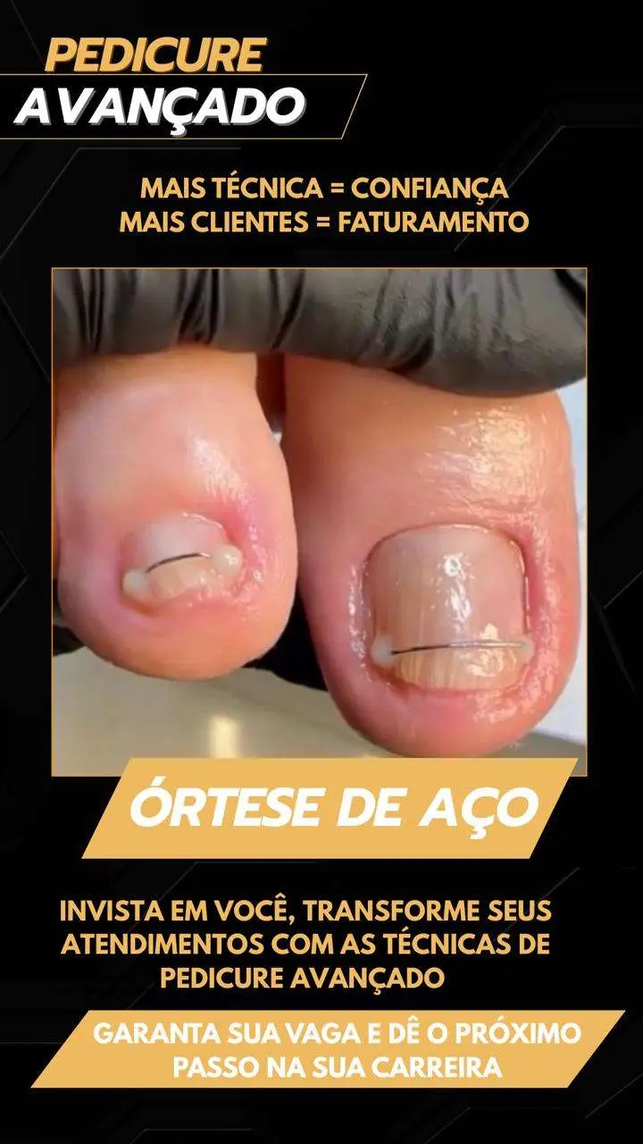 Peeling avançado Podocure